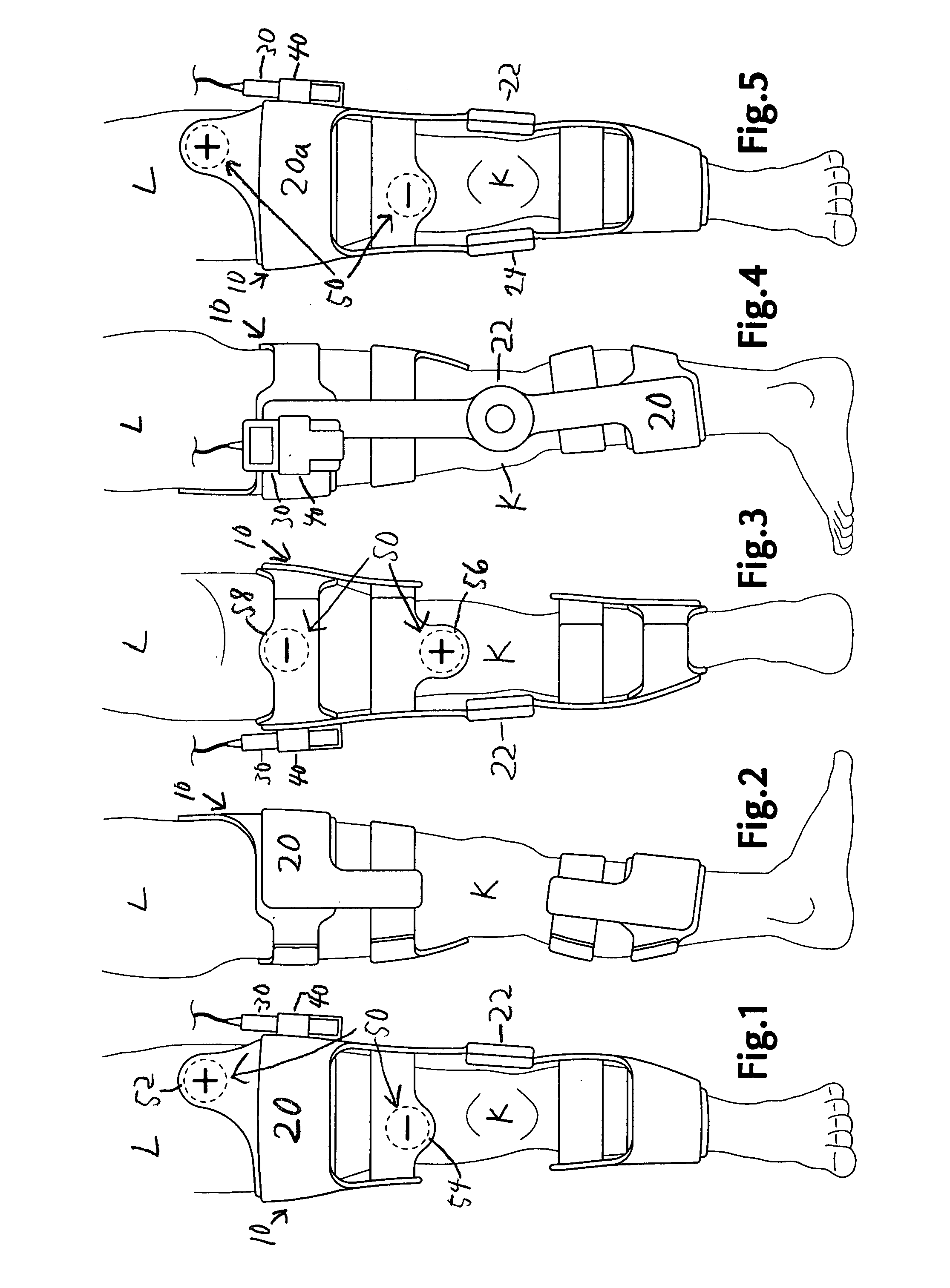 Apparatus for surface electrical stimulation and stabilization to treat disorders of the joints