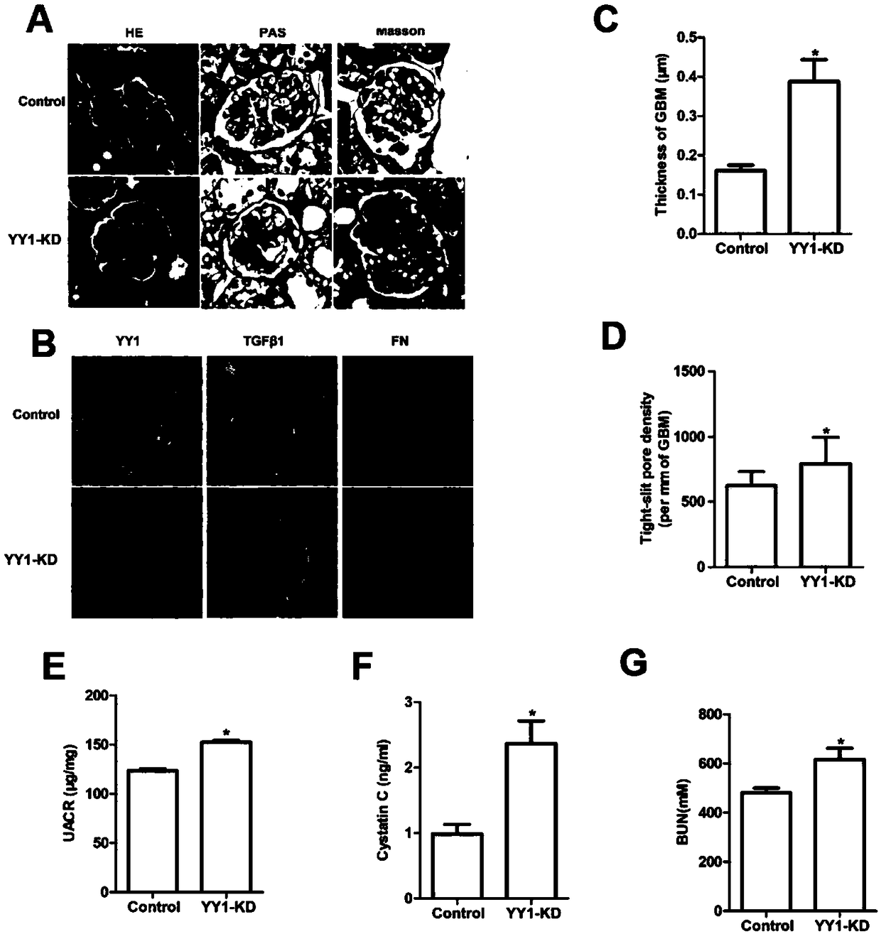 Recombinant virus and application thereof in preparation of medicine for preventing or treating renal fibrosis