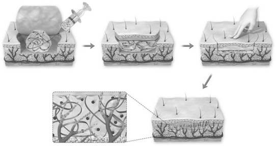 Silk protein nanofiber gel dressing with pressure spreadability, its preparation method and application