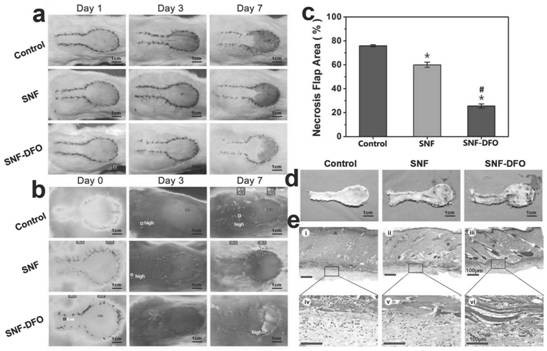 Silk protein nanofiber gel dressing with pressure spreadability, its preparation method and application