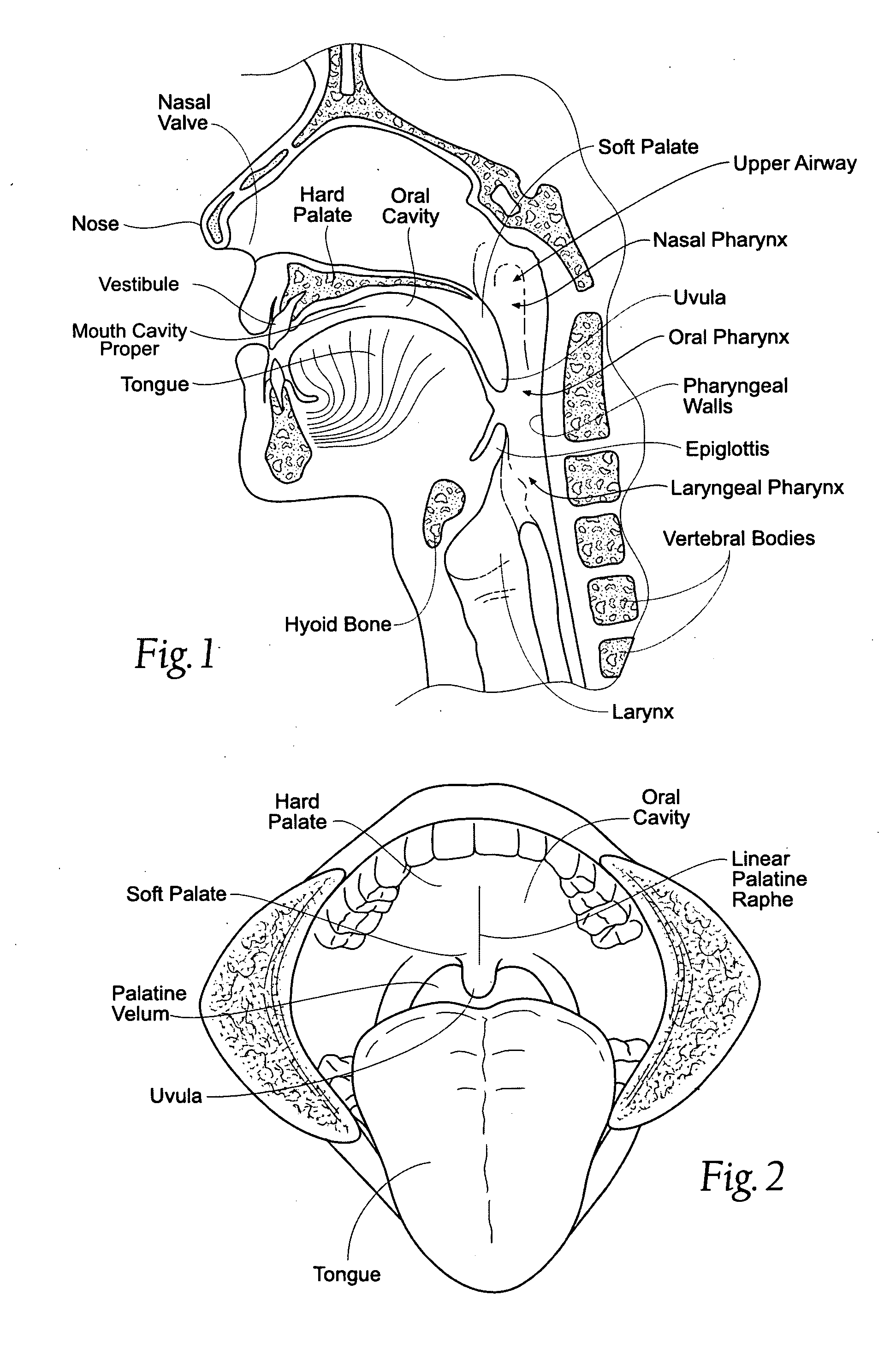 Magnetic devices, systems, and methods placed in or on a tongue