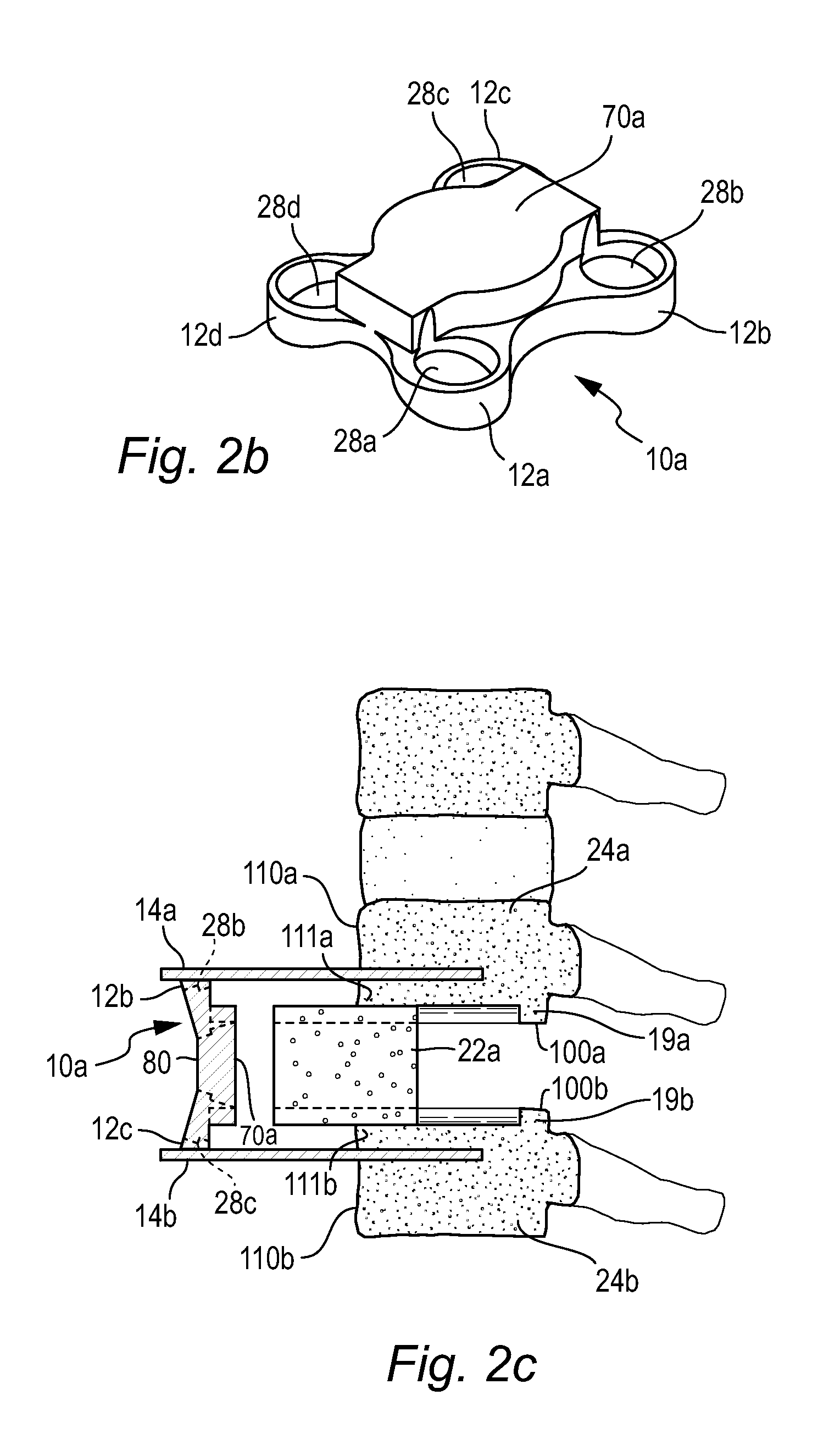 Low-profile anterior vertebral plate assemblies and methods of use