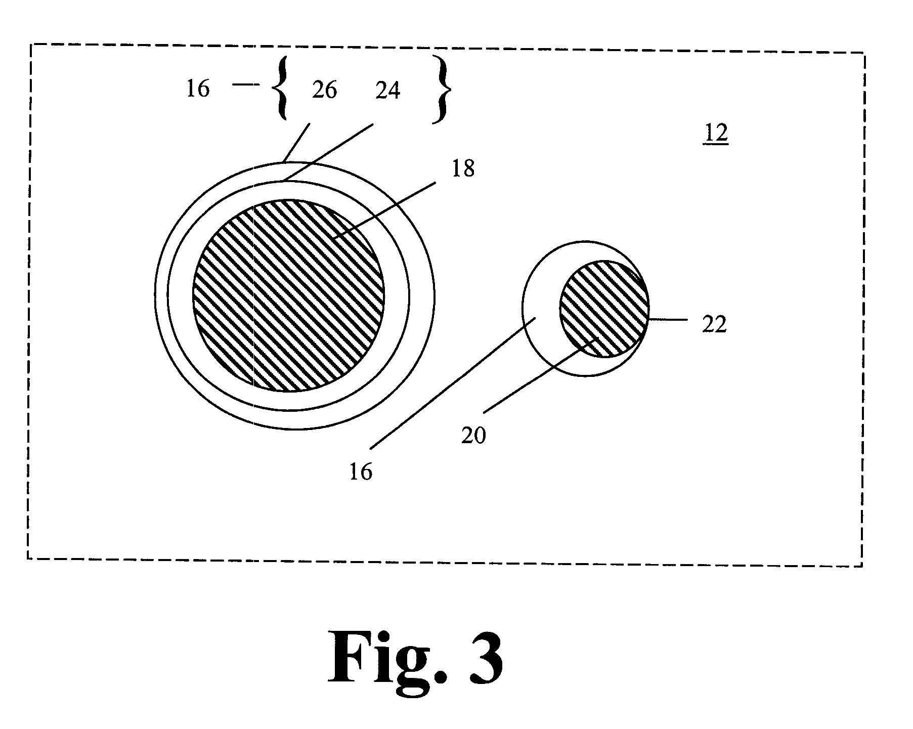 Radiation Detector Assembly, Radiation Detector, and Method for Radiation Detection