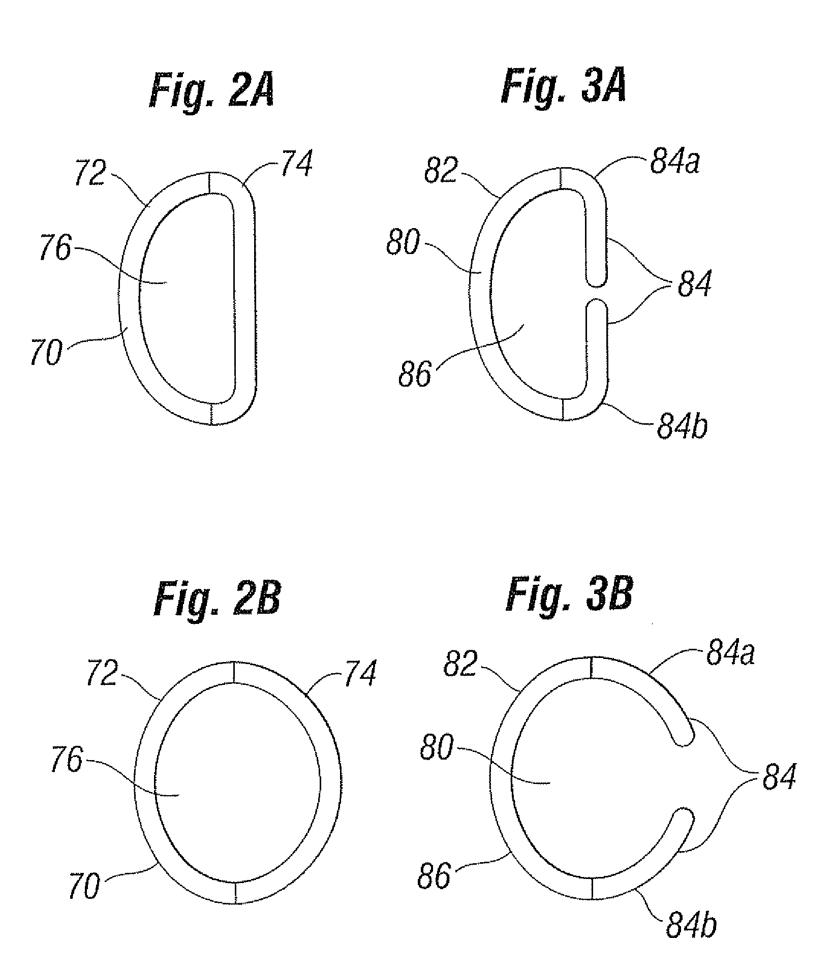 Transformable annuloplasty ring configured to receive a percutaneous prosthetic heart valve implantation