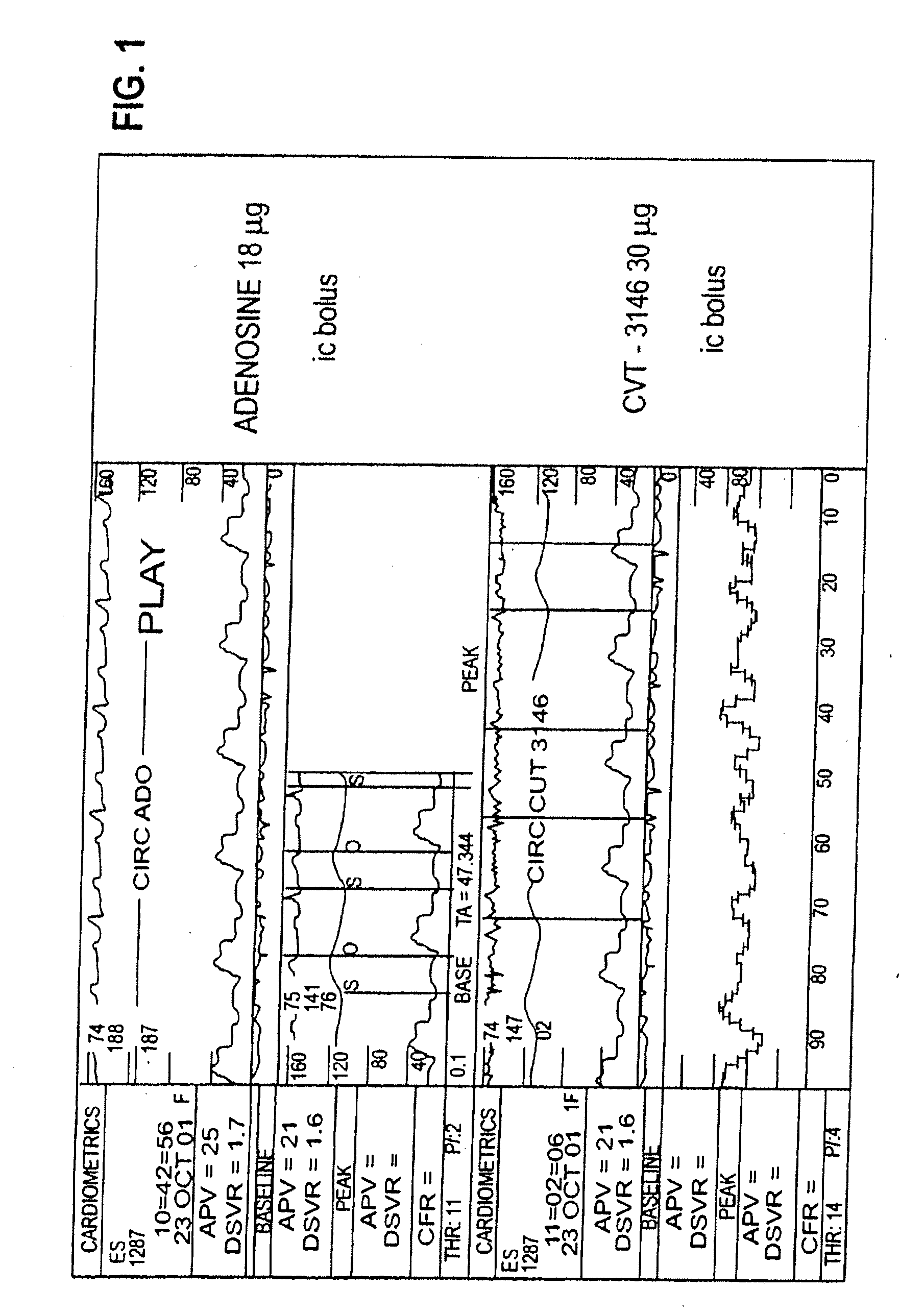 Myocardial perfusion imaging methods and compositions