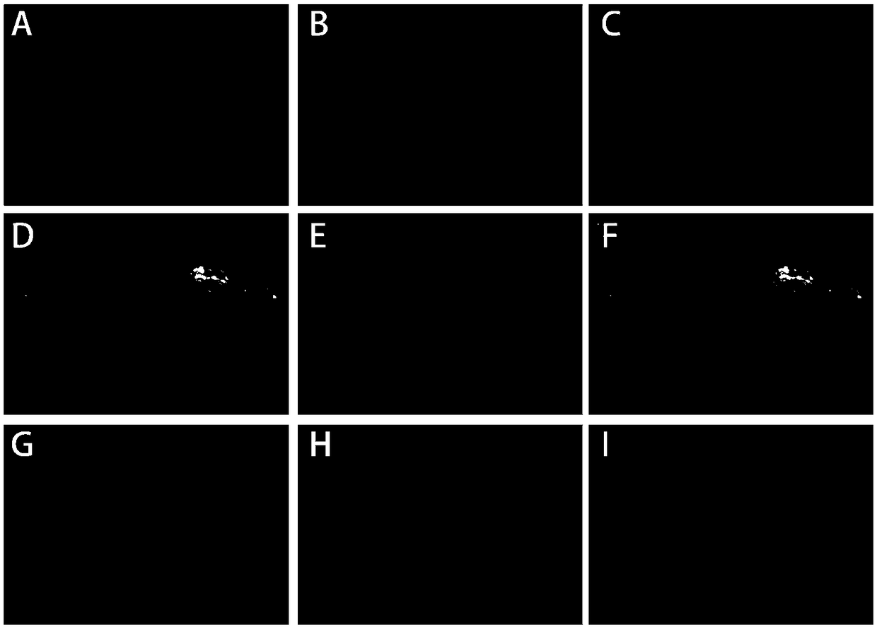 An immunofluorescent staining method and its kit for rapidly evaluating testicular spermatogenic function