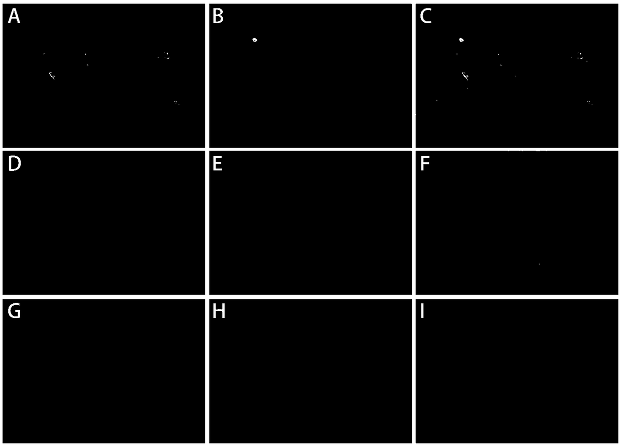 An immunofluorescent staining method and its kit for rapidly evaluating testicular spermatogenic function