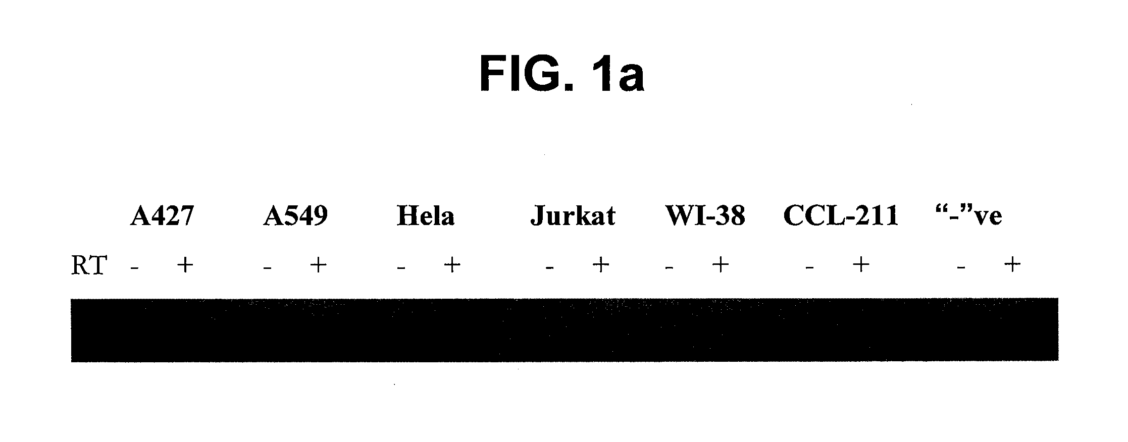 Protein kinase CK2 gene mutations, amplifications and polymorphisms in human cancers and methods of use