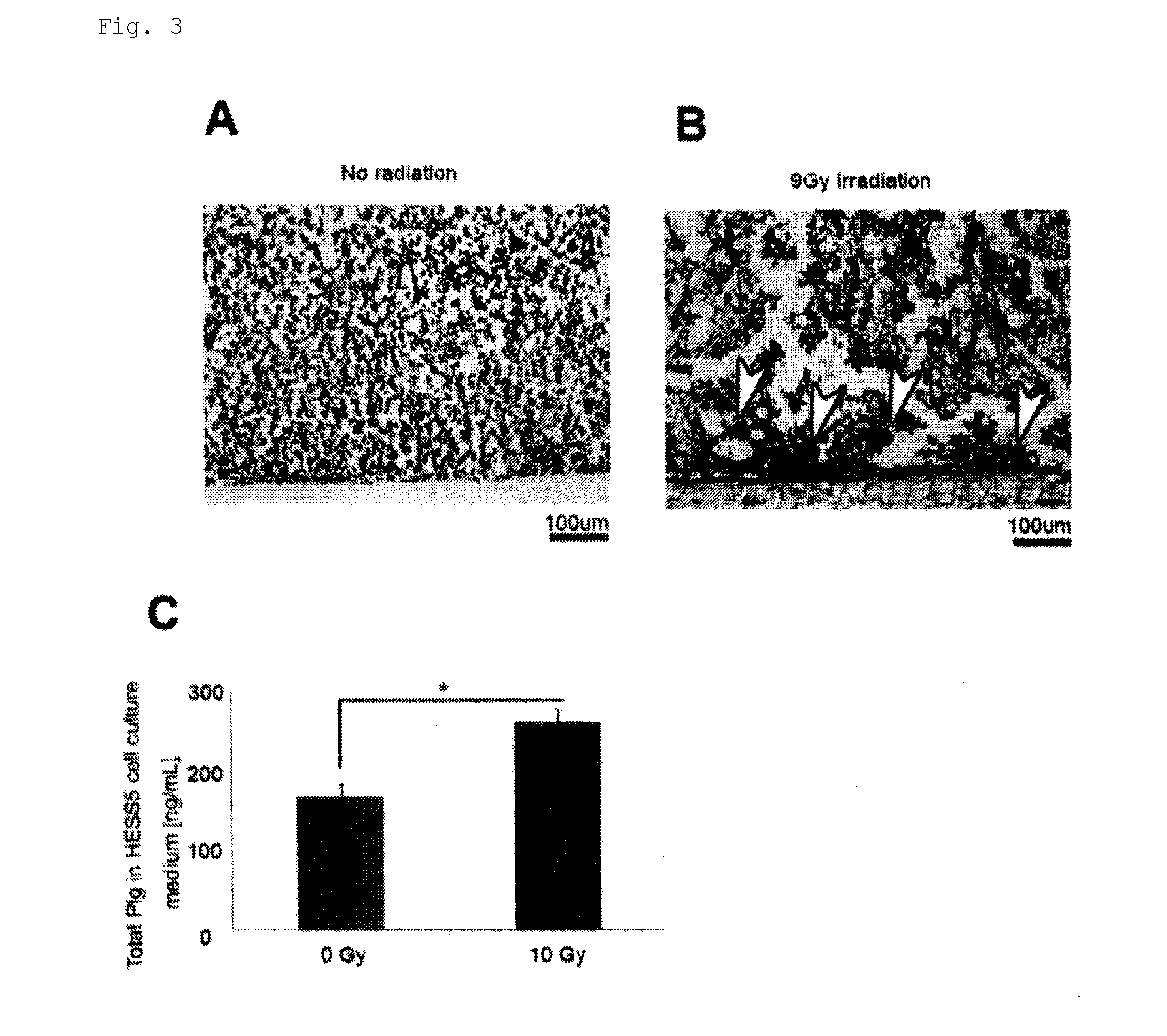 Novel use for pai-1 inhibitor