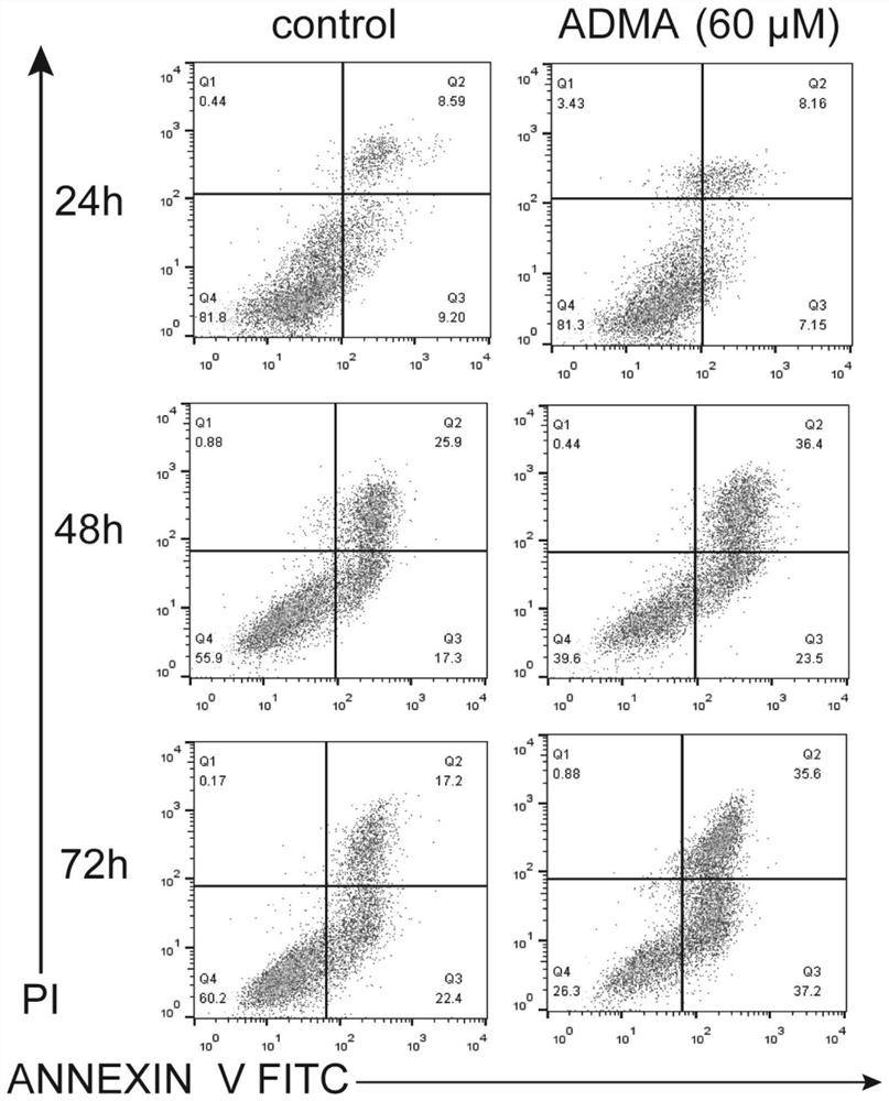 Application of PRMT3 in diagnosis or treatment of recurrent spontaneous abortion