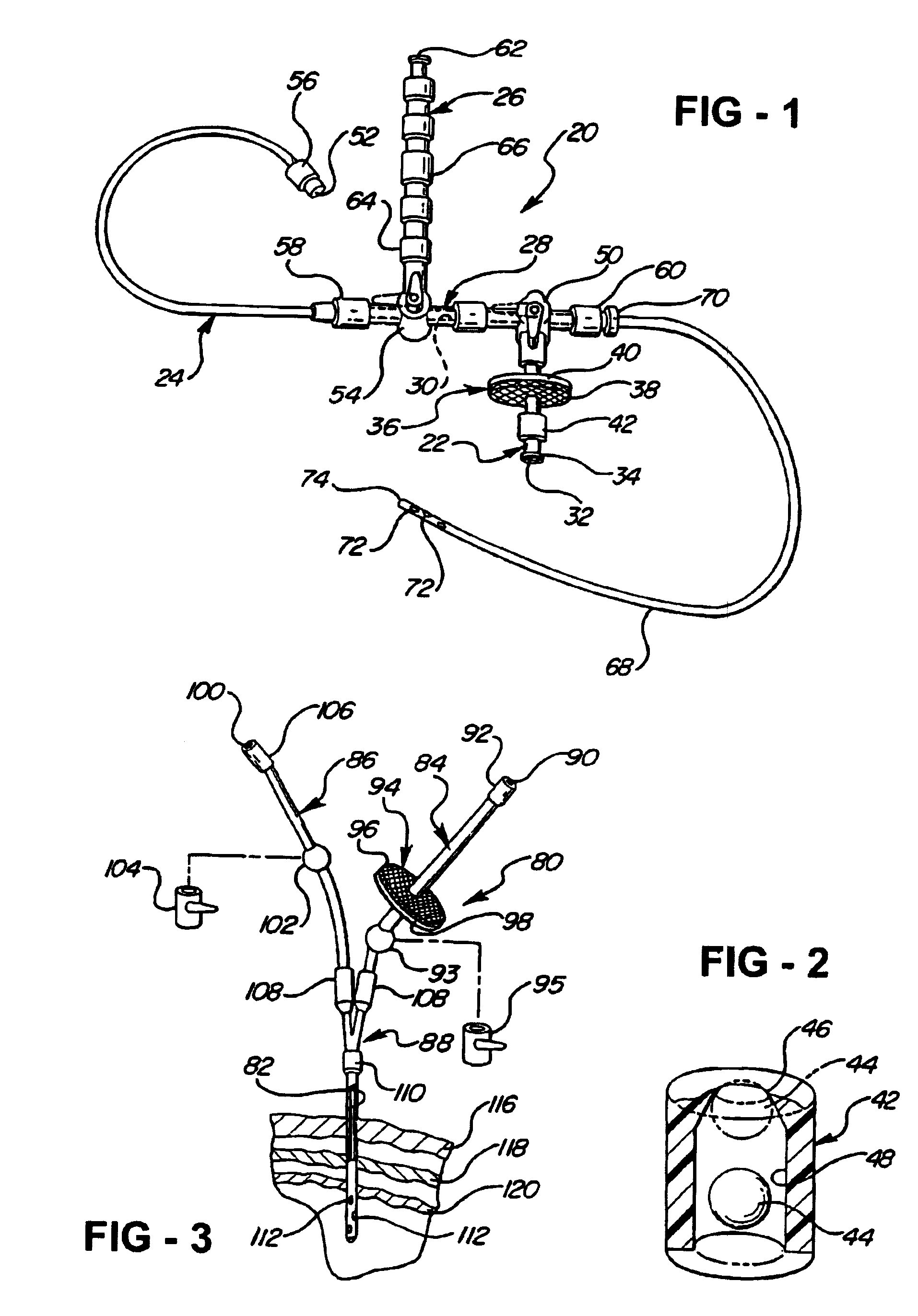 Direct central nervous system catheter and temperature control system