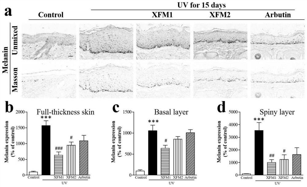 External whitening and freckle-removing essence snow skin rice for treating skin stains and preparation method and application thereof