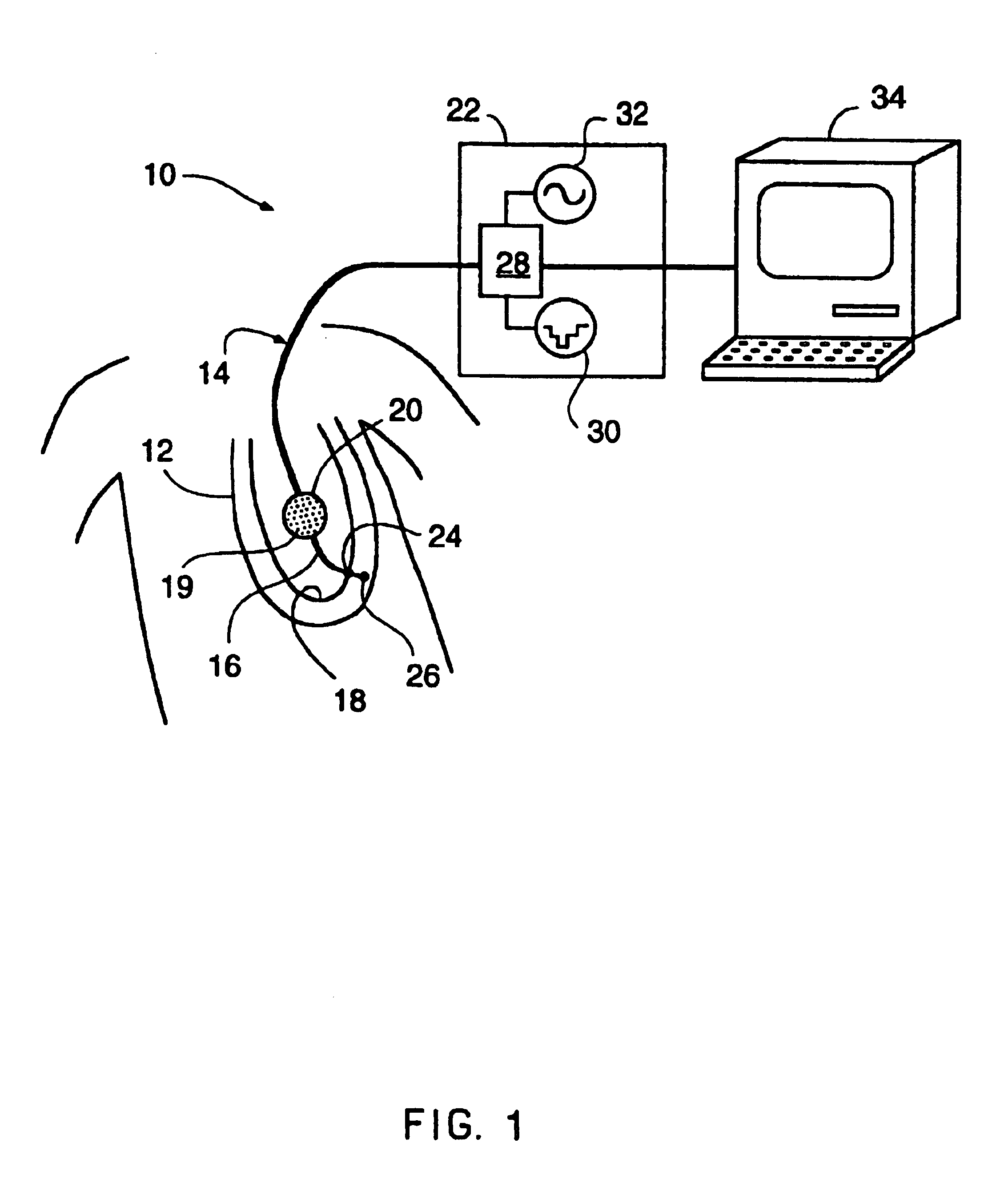 Method of mapping a plug in a mapping catheter
