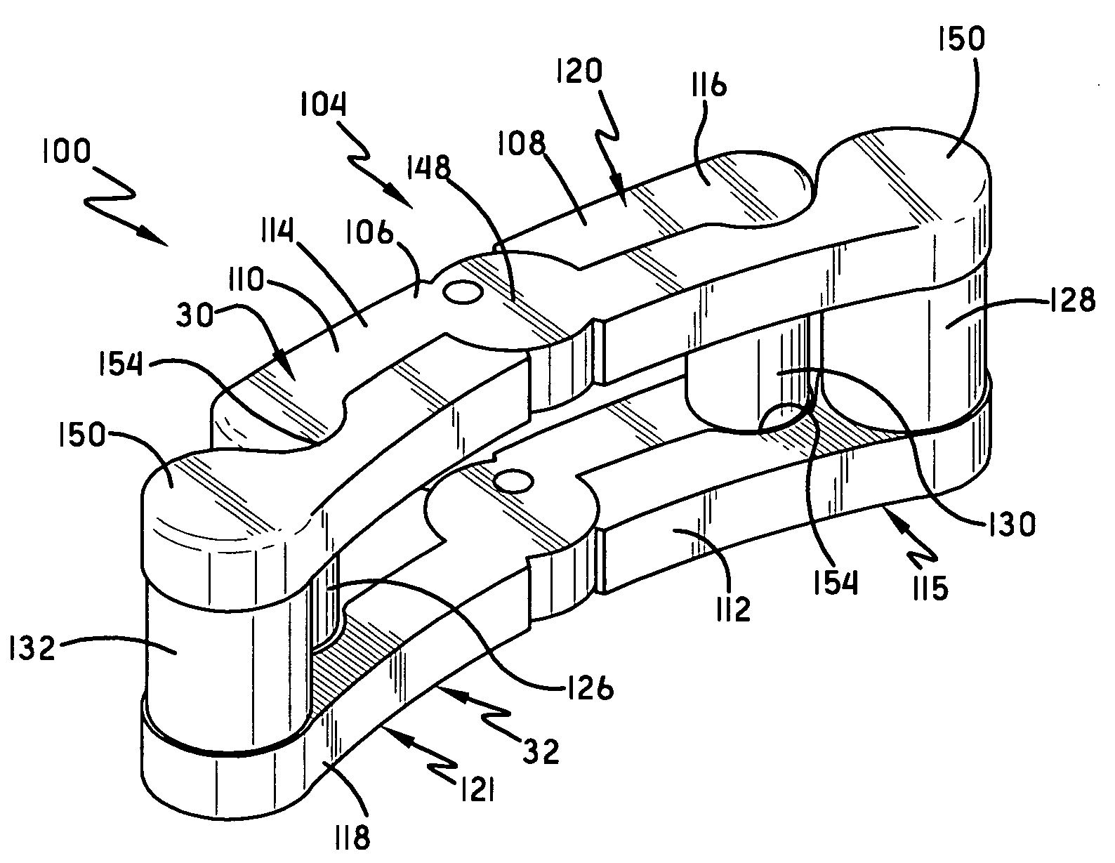 Spine surgery method and motion preserving implant