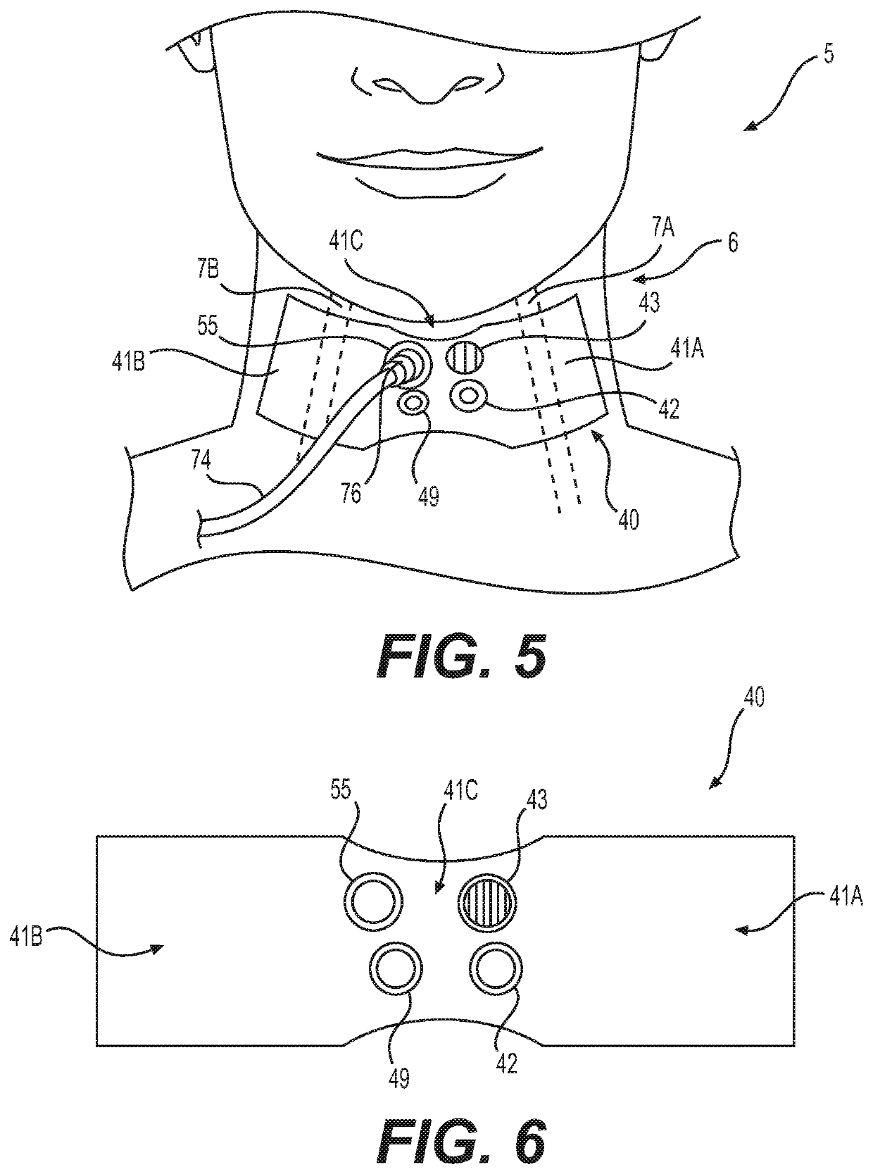 Stand-alone continuous cardiac doppler and acoustic pulse monitoring patch with integral visual and auditory alerts, and patch-display system and method