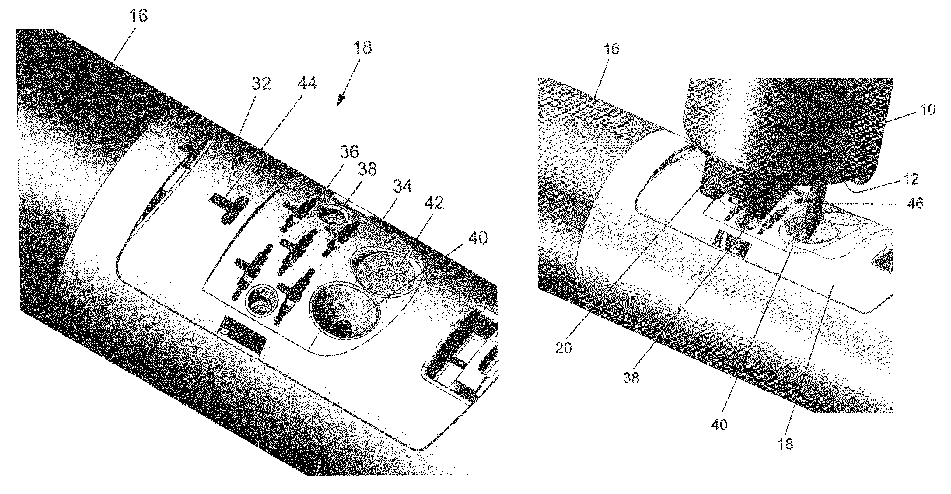 Medical device comprising alignment systems for bringing two portions into alignment