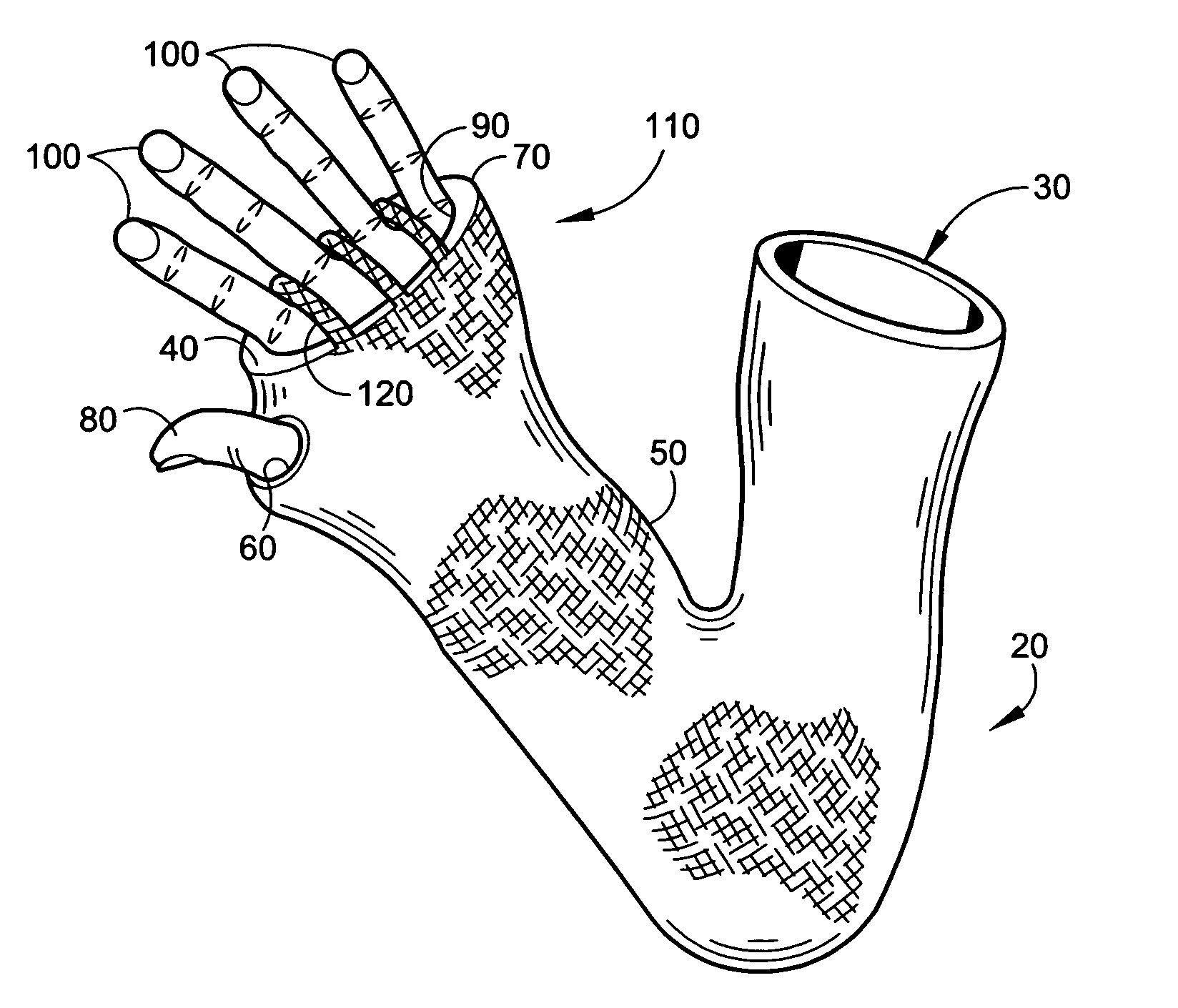 Cast cover and method of use