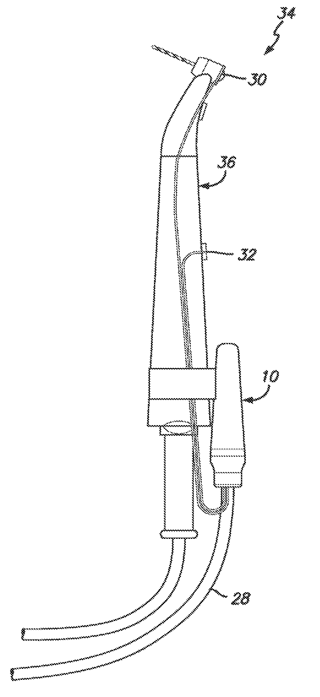 Method and device for reducing angulation error during dental procedures