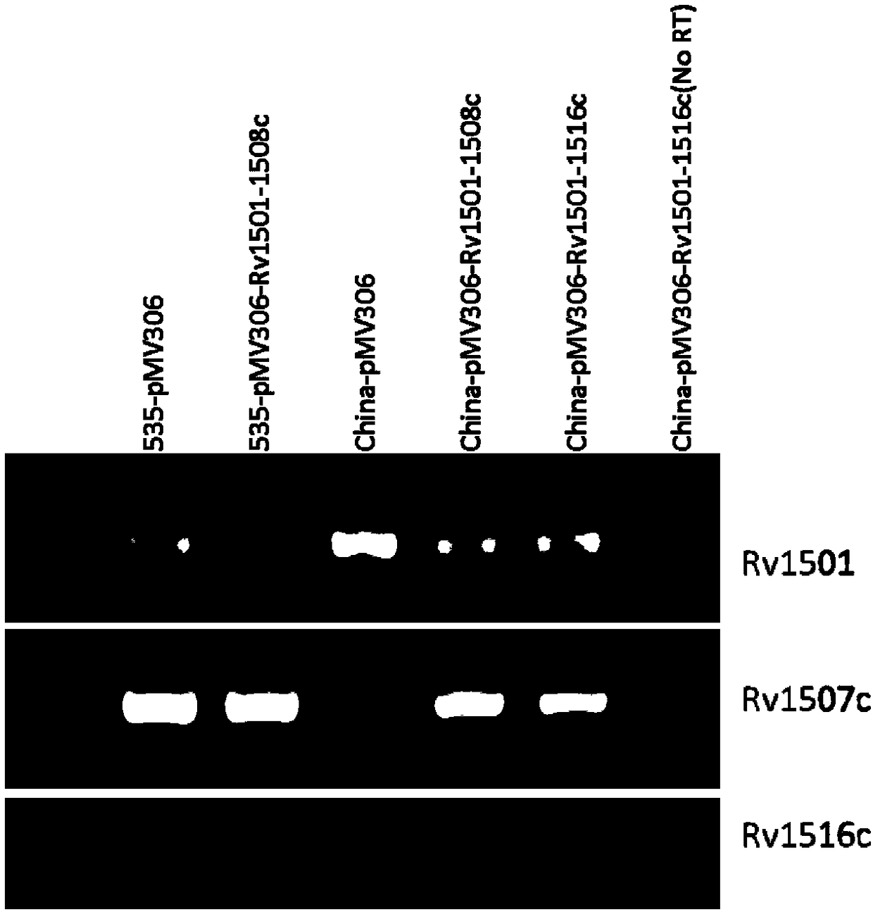 Recombinant bacillus calmette guerin vaccine, and applications thereof