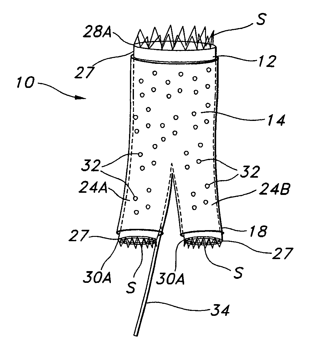 Tubular prosthesis for external agent delivery