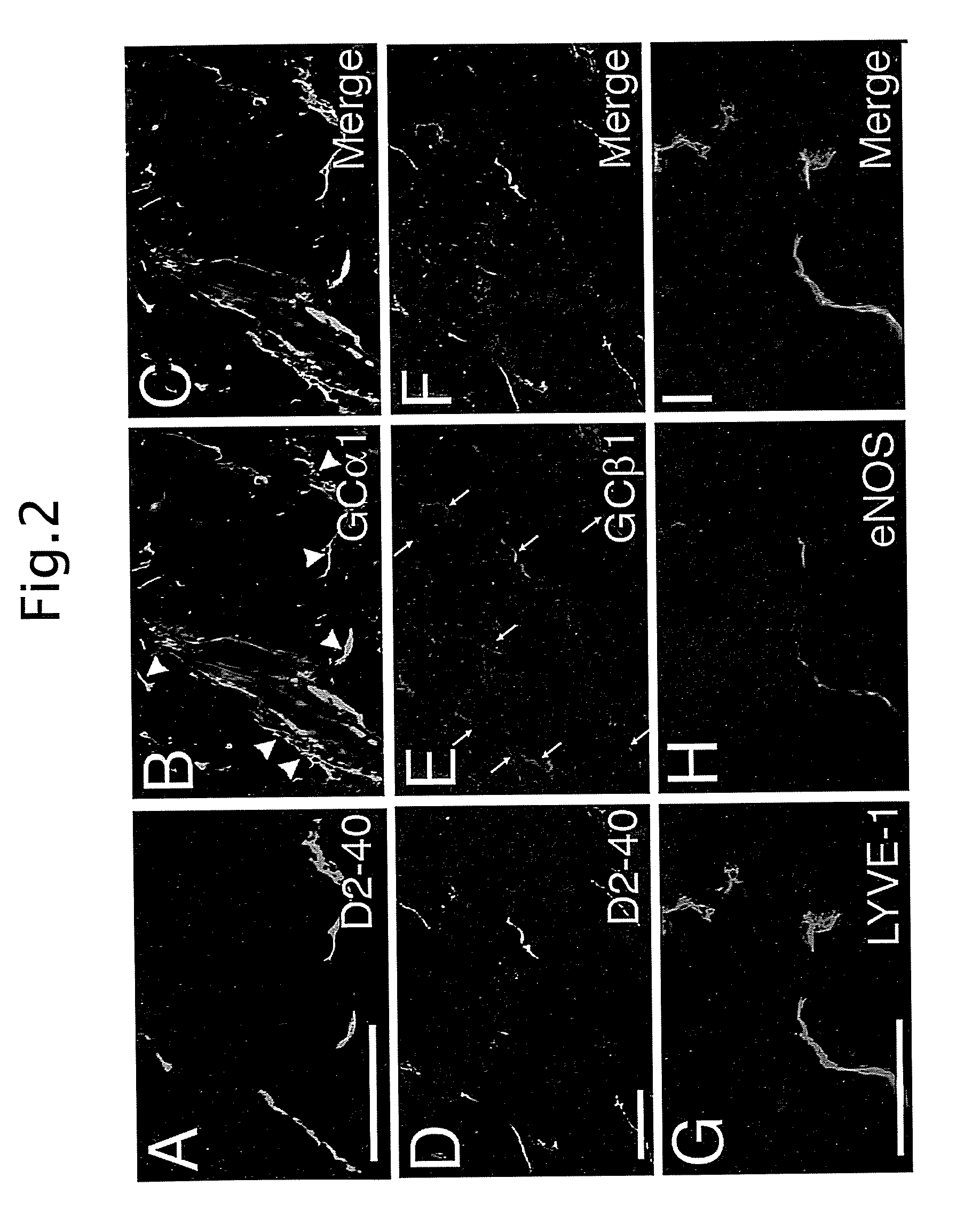 Method for inhibiting lymphangiogenesis and inflammation
