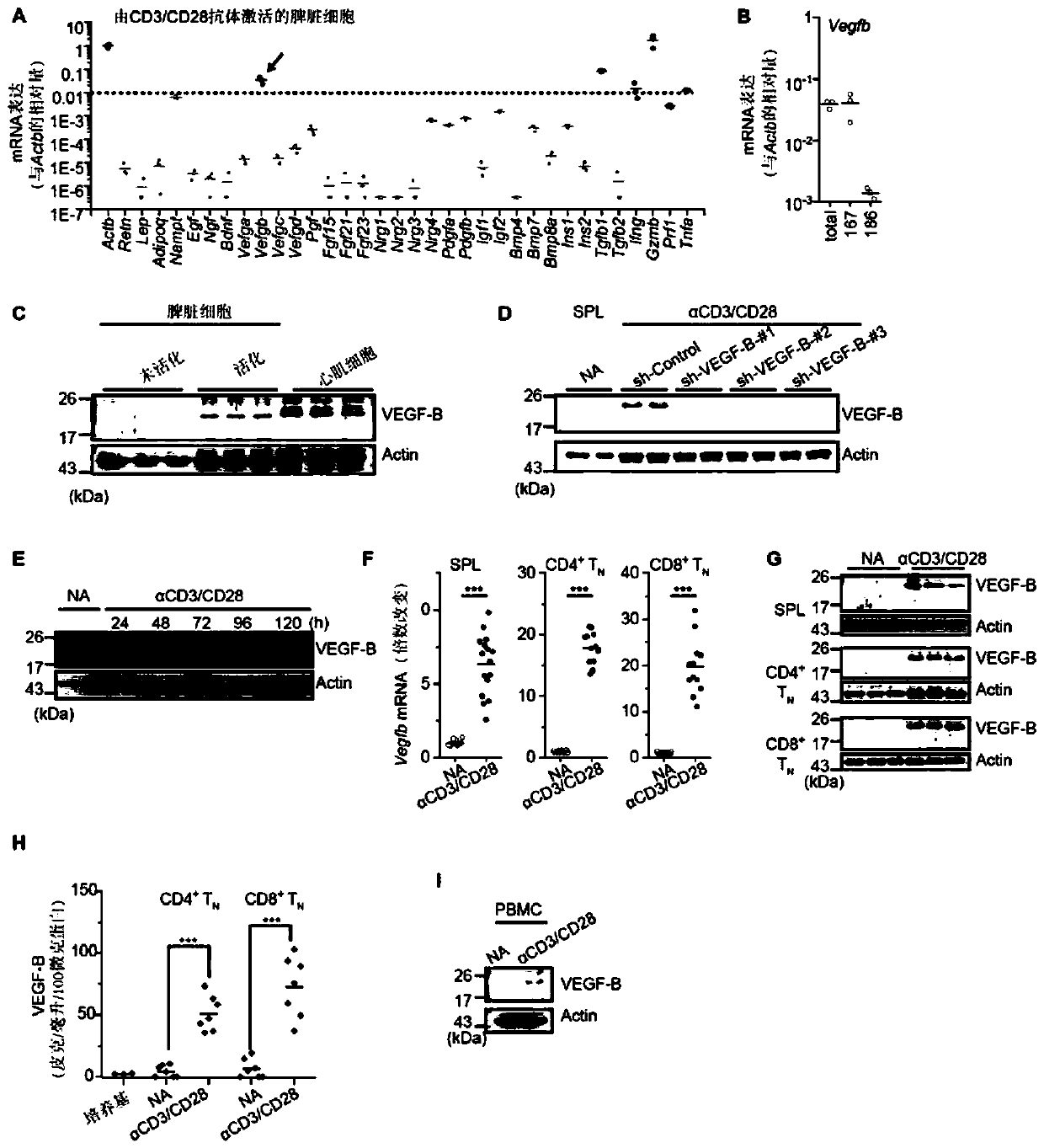 Application of autocrine VEGFB to T cell metabolism and functions as well as tumor immunity treatment