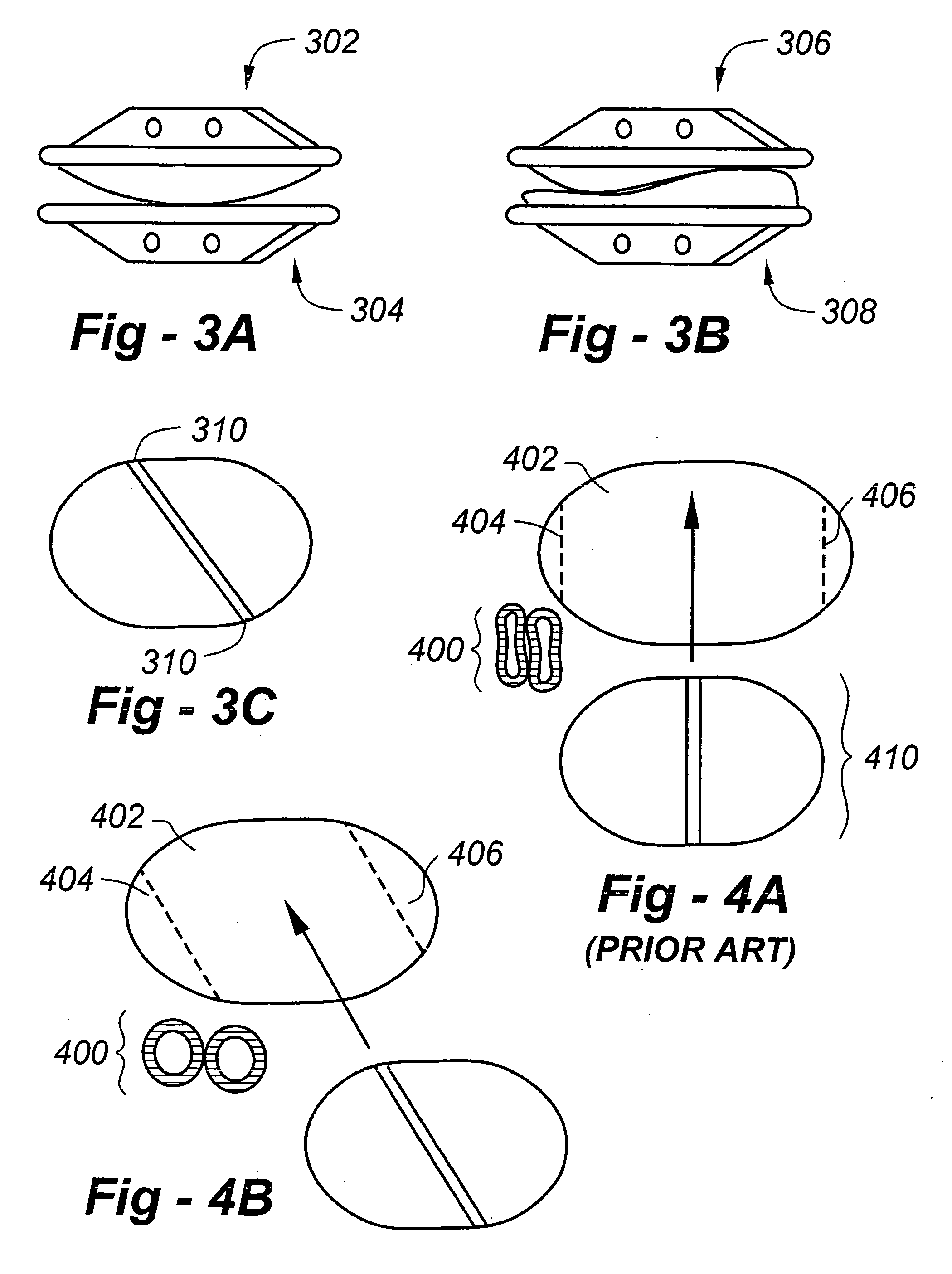 Method and apparatus for total disc replacements with oblique keels