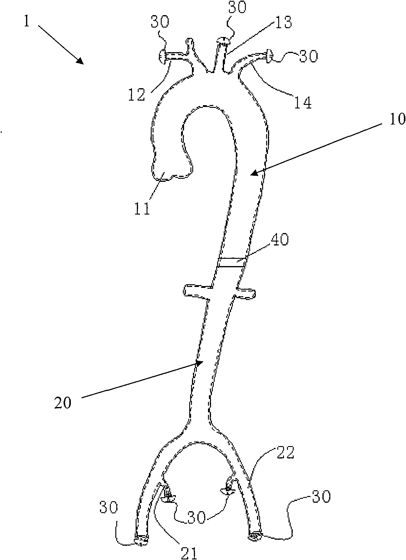 Blood vessel model and blood circulation simulating device using same