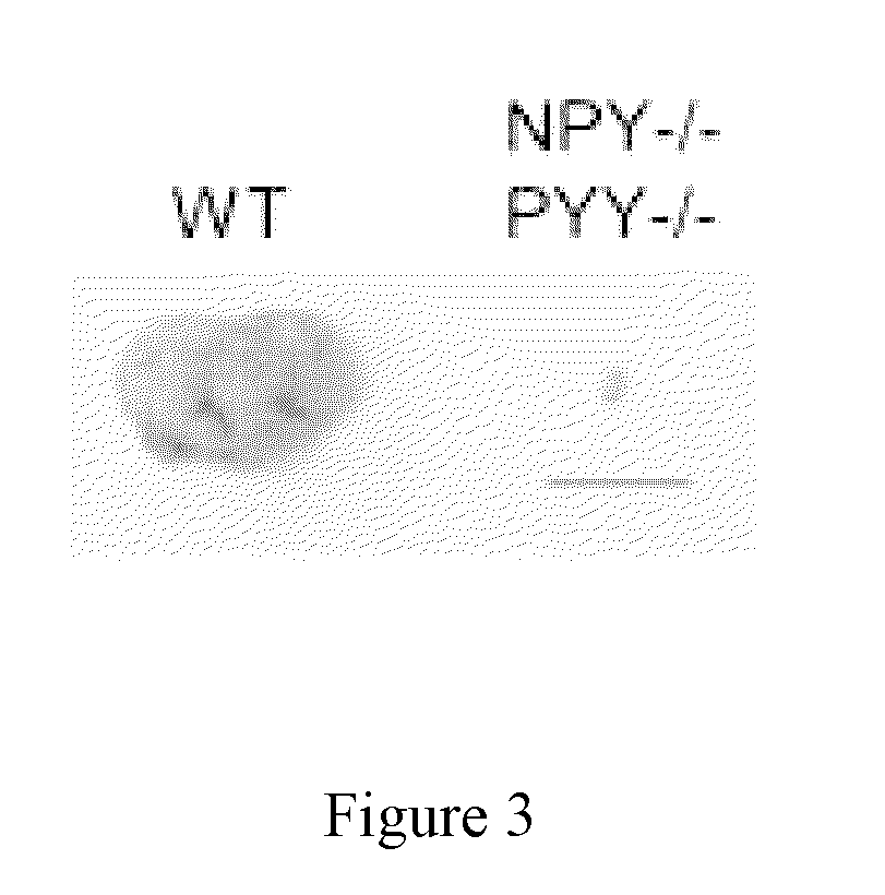 Anti-npy and pyy antibodies and uses thereof