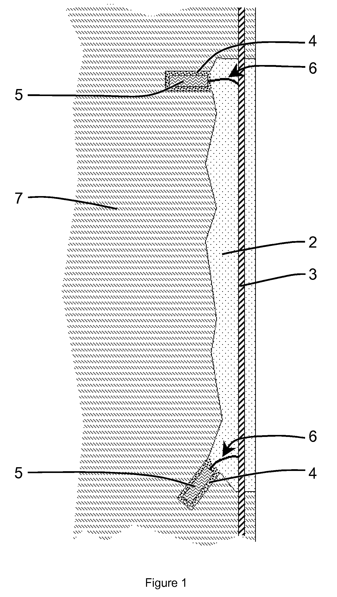 Sacrificial anodes in concrete patch repair