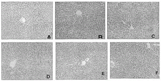 Drug for treating nonalcoholic fatty liver disease and application of drug