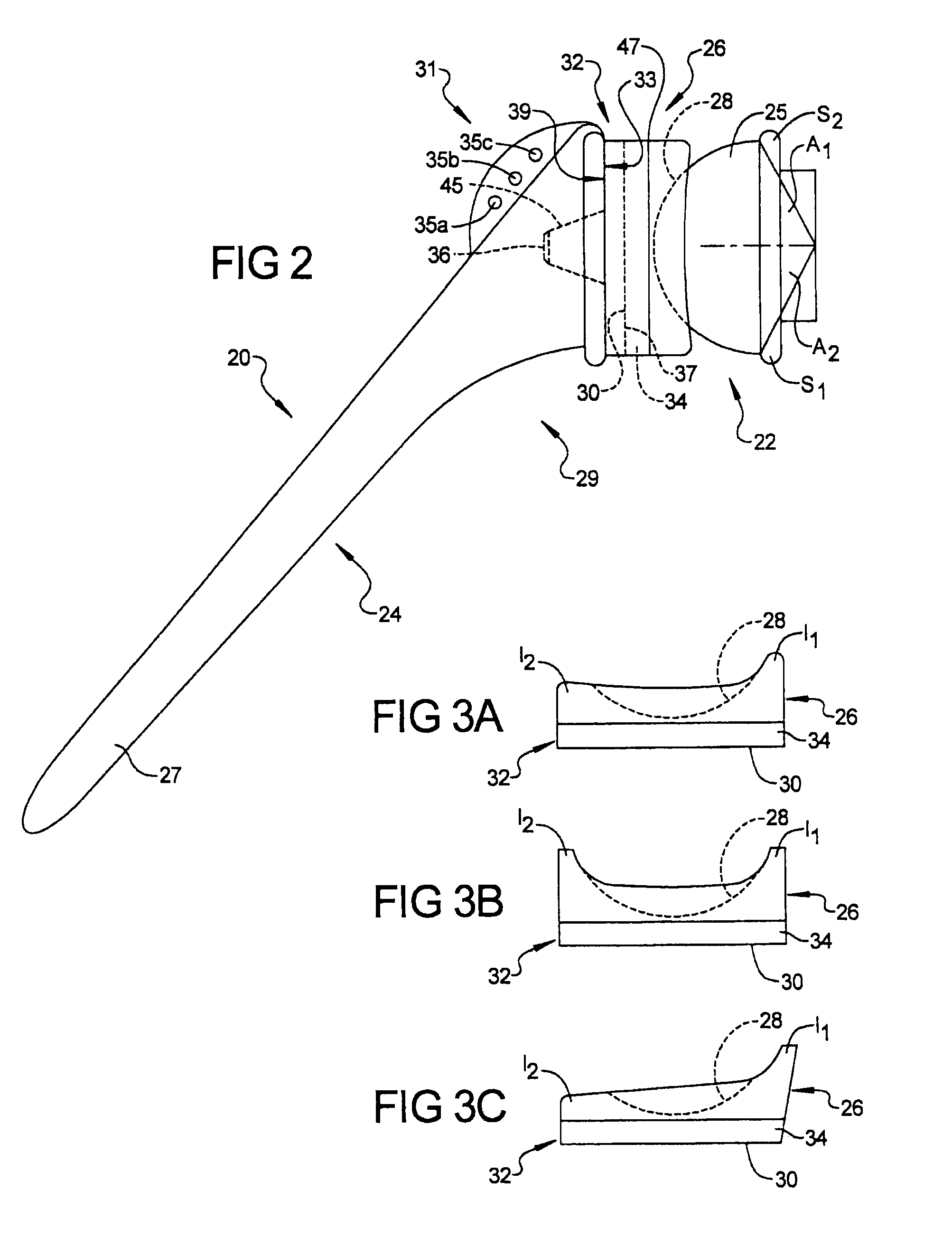 Humeral Implant Having A Floating Bearing