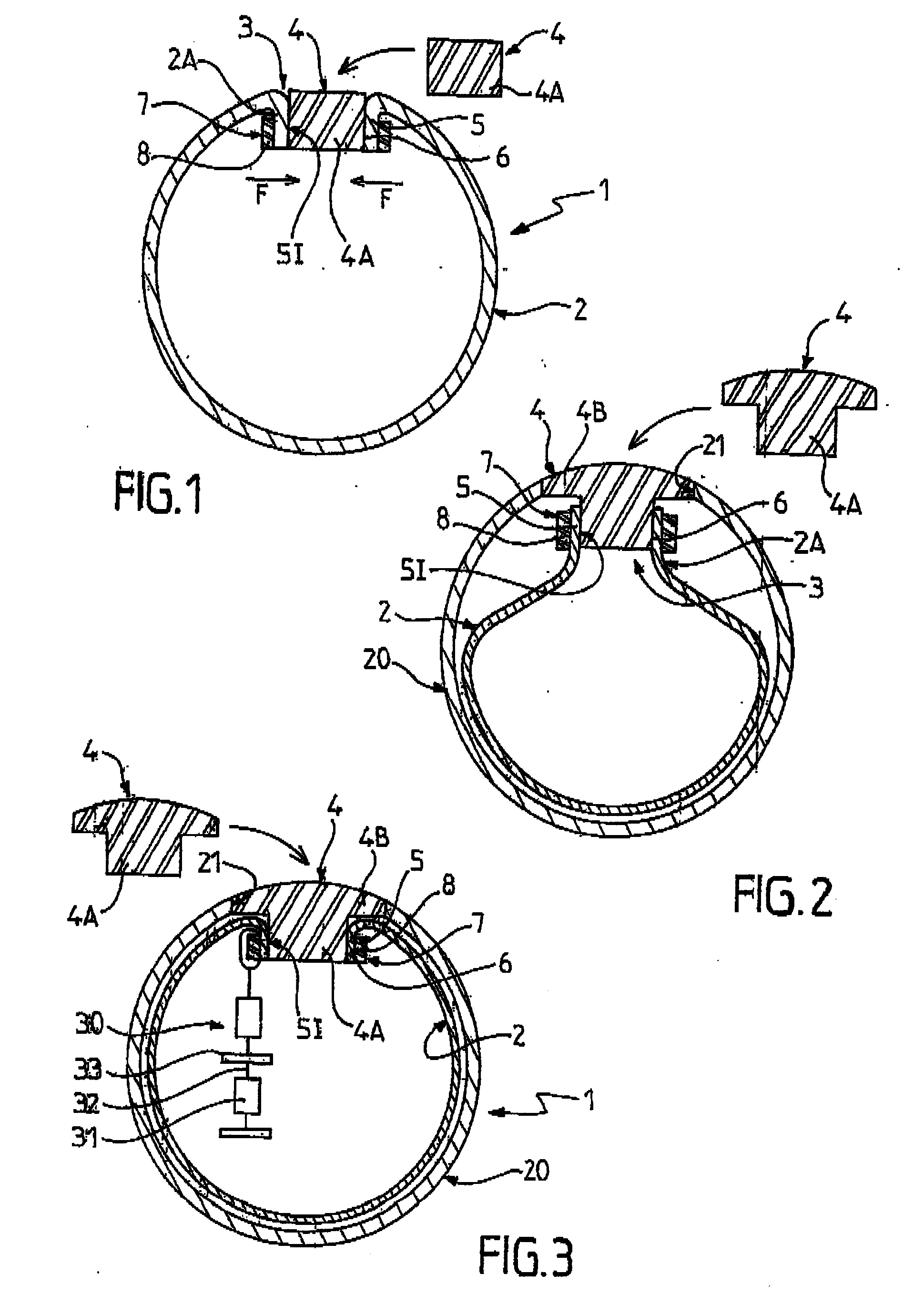 Pouch-Equipped Intragastric Balloon