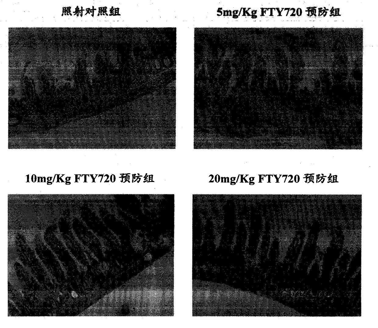 Application of s1p receptor modulator in prevention and treatment of intestinal radiation sickness and radiation enteritis