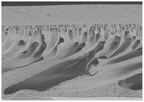 A kind of bipolar membrane with porous anodic membrane as base material and preparation method thereof