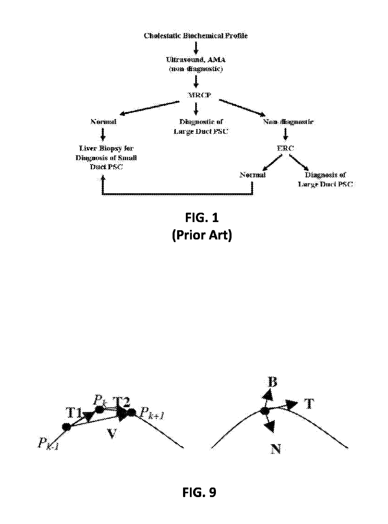 Method and apparatus for generating quantitative data for biliary tree structures