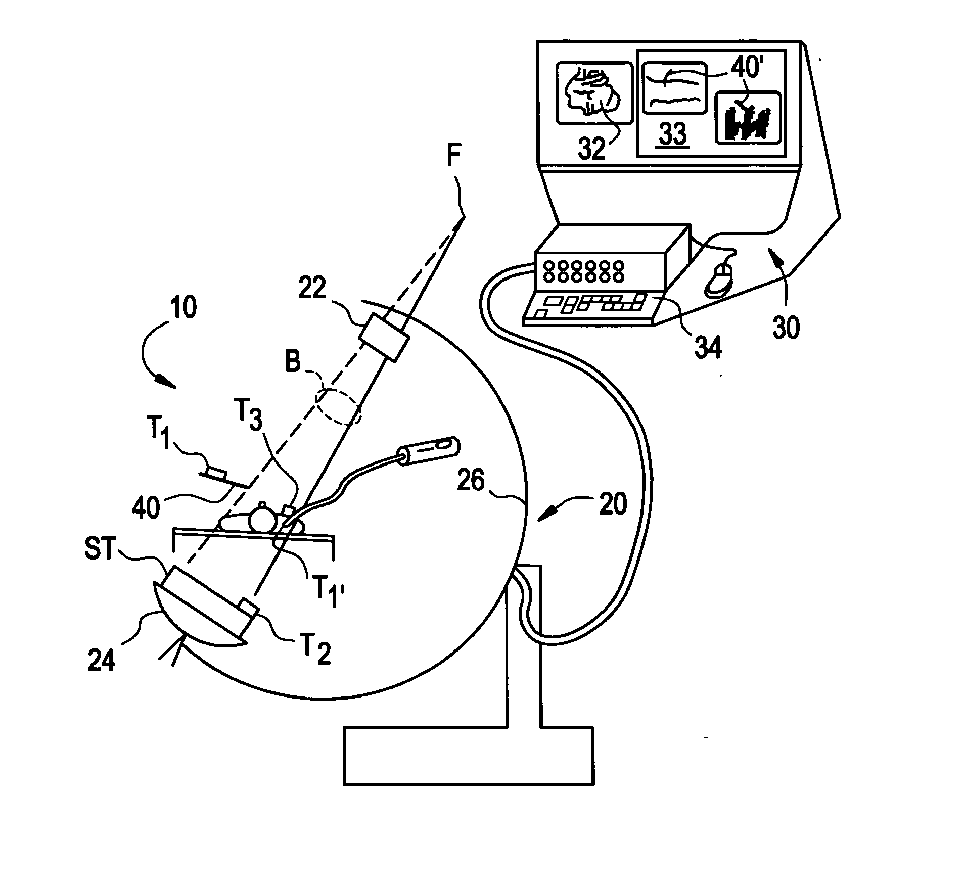 System and method for integration of a calibration target into a C-arm