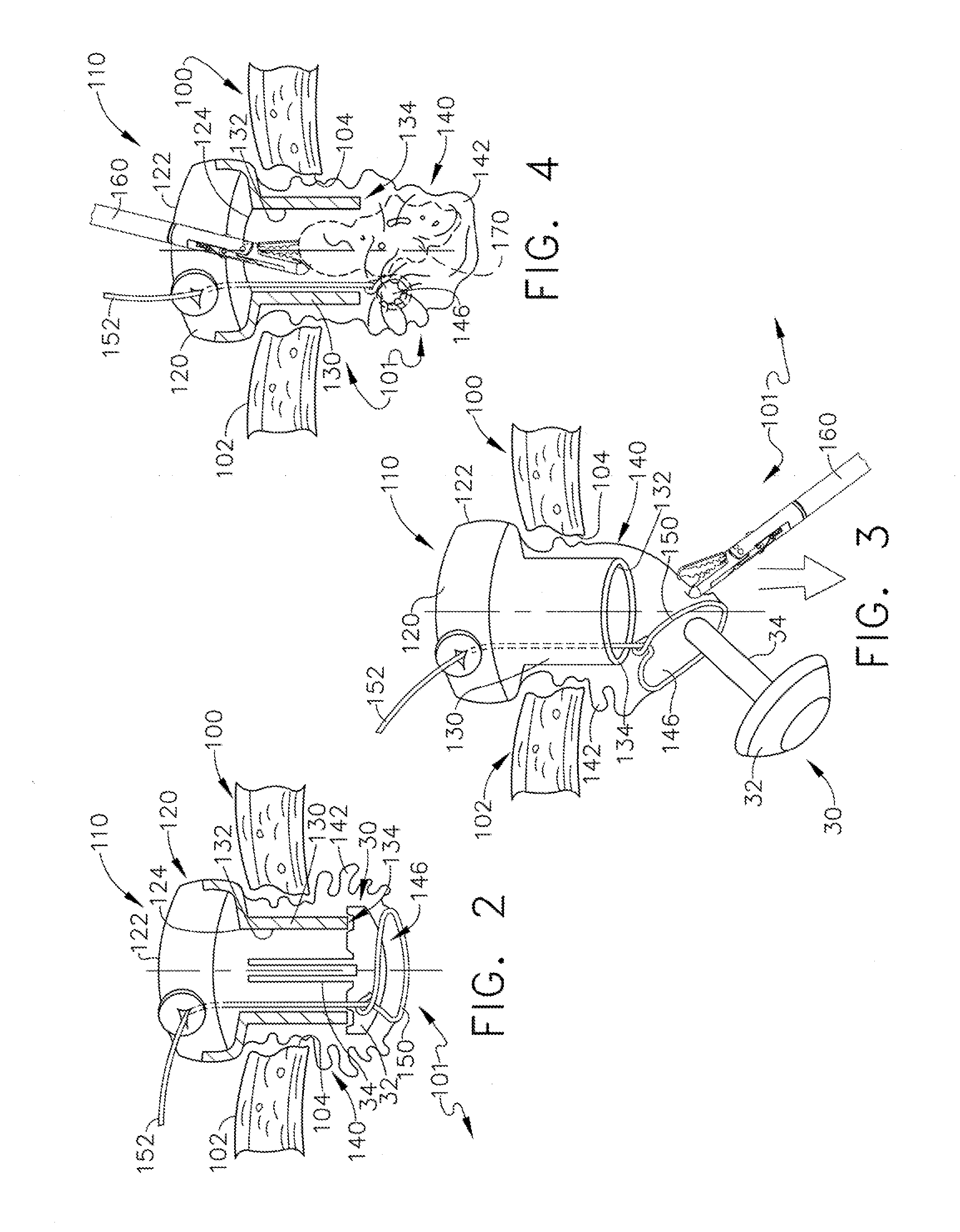 Surgical access devices with anvil introduction and specimen retrieval structures