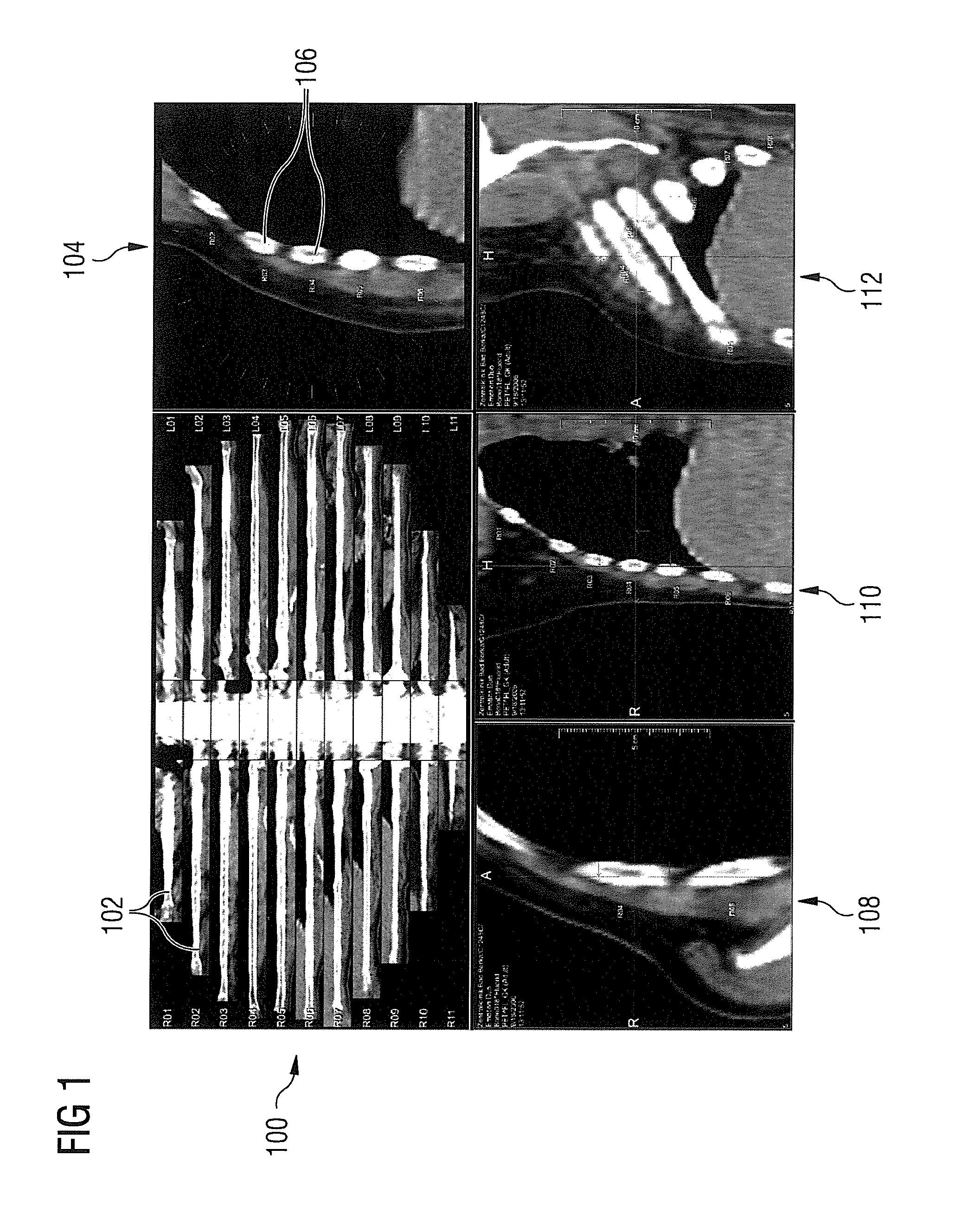 Method and apparatus for generating an enhanced image from medical imaging data
