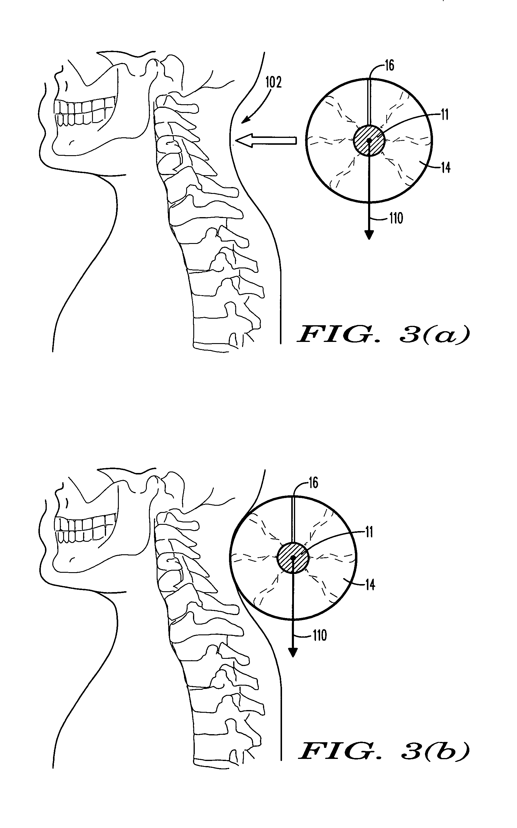 Method and apparatus for improving posture