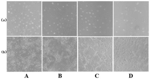 Quad-synapsis complex cell model of diabetic concurrent depression and building method and application thereof