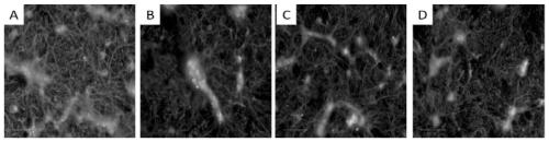 Quad-synapsis complex cell model of diabetic concurrent depression and building method and application thereof