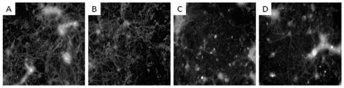 Quad-synapsis complex cell model of diabetic concurrent depression and building method and application thereof