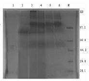Chicken IL-18 (Interleukin-18) and Newcastle disease virus HN (Hemagglutinin-neuraminidase) gene recombinant fusion protein and application