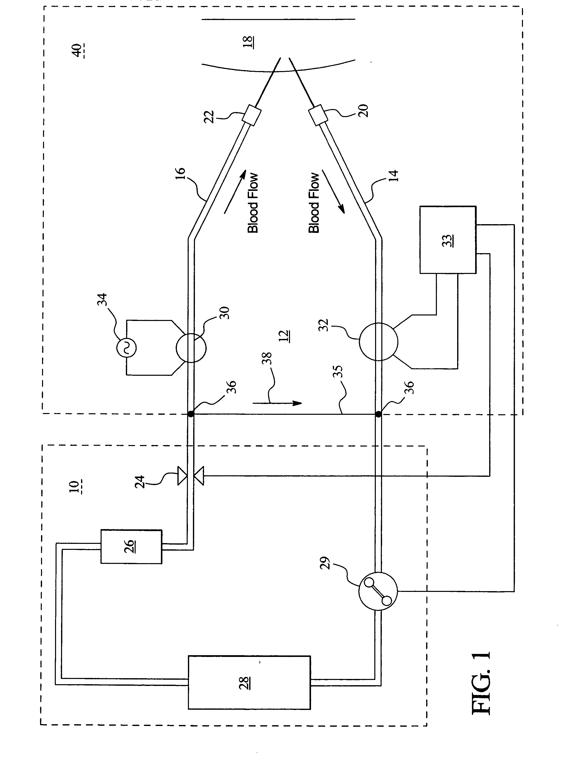 Access disconnection systems and methods