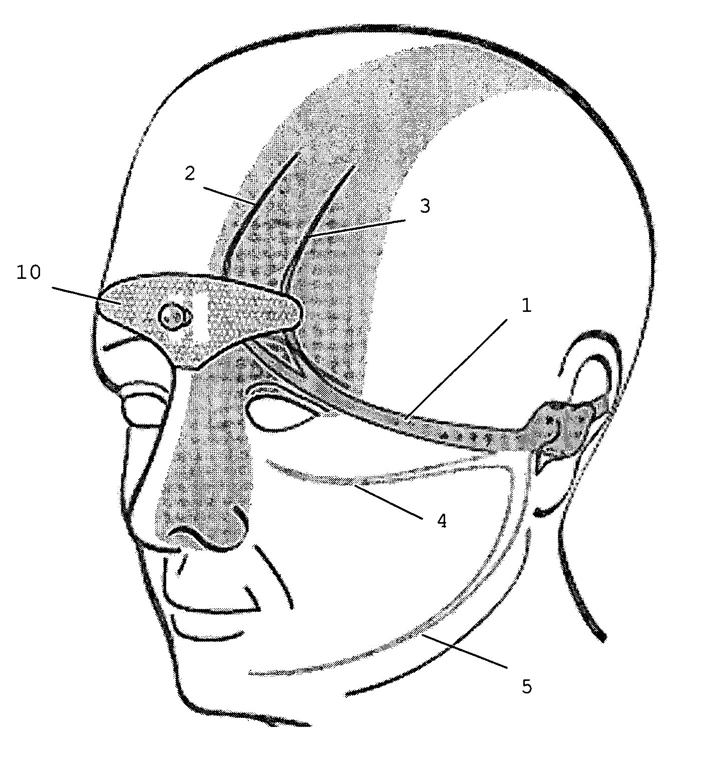 Device for the electrotherapeutic treatment of tension headaches