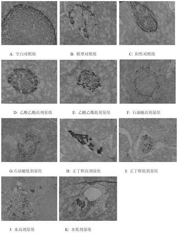 Watermelon vine extract capable of treating diabetes as well as preparation method and application of watermelon vine extract