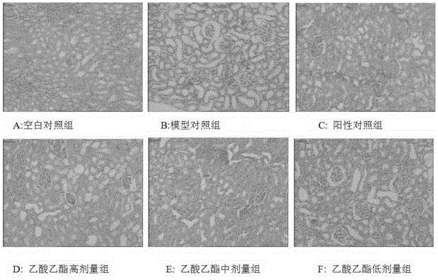 Watermelon vine extract capable of treating diabetes as well as preparation method and application of watermelon vine extract