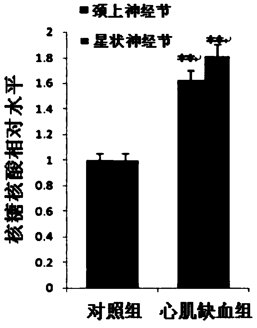 Application of nonratt021972 small interfering RNA in the preparation of drugs for myocardial ischemia injury and sympathetic nerve disease