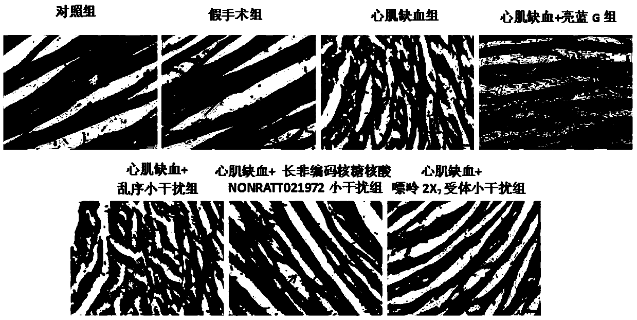 Application of nonratt021972 small interfering RNA in the preparation of drugs for myocardial ischemia injury and sympathetic nerve disease